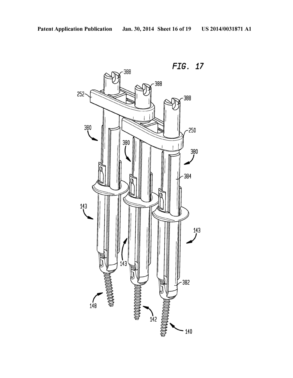 ROD CONTOURING METHOD FOR PERCUTANEOUS PEDICLE SCREW EXTENSION - diagram, schematic, and image 17