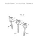 ROD CONTOURING METHOD FOR PERCUTANEOUS PEDICLE SCREW EXTENSION diagram and image