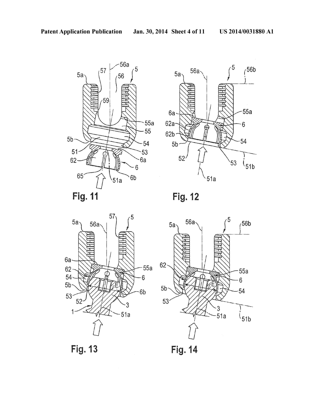 POLYAXIAL BONE ANCHORING DEVICE WITH ENLARGED PIVOT ANGLE - diagram, schematic, and image 05