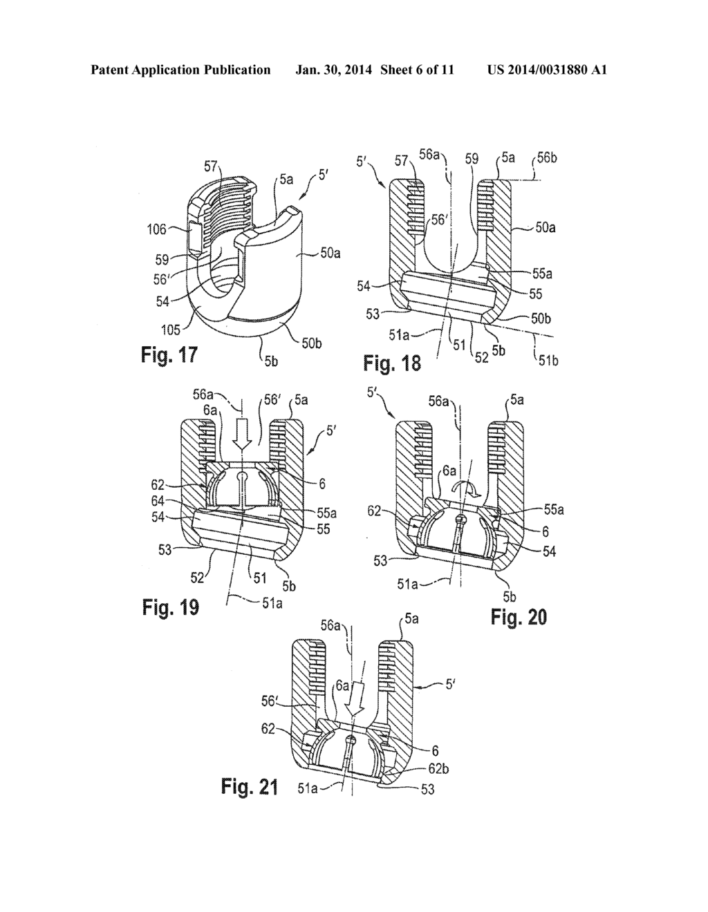 POLYAXIAL BONE ANCHORING DEVICE WITH ENLARGED PIVOT ANGLE - diagram, schematic, and image 07