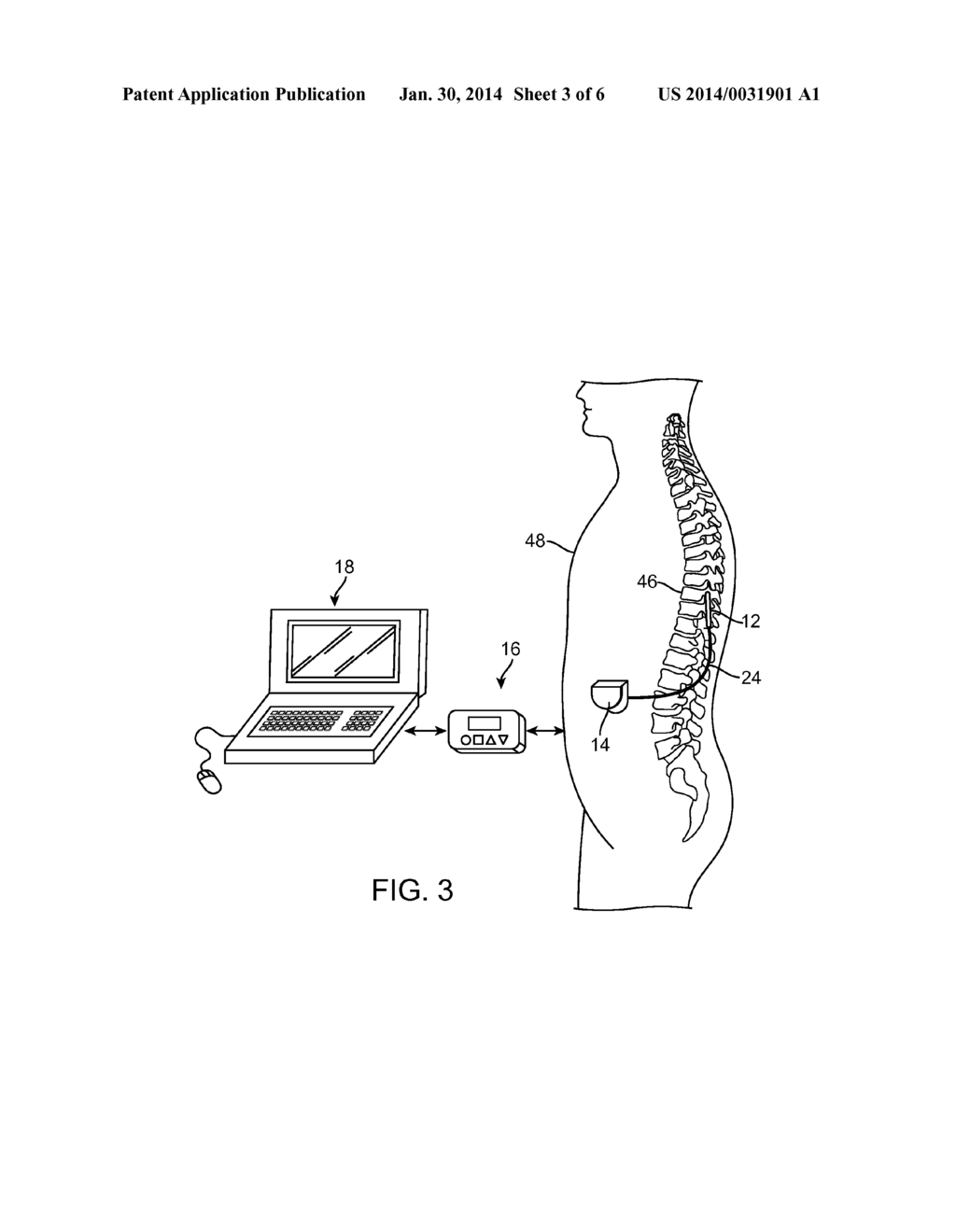 TECHNIQUES FOR ELECTRONICALLY ASSESSING ELECTRODE CONDITION AND     PERI-ELECTRODE TISSUE CONDUCTIVITY CHANGE PRE- AND POST-MRI - diagram, schematic, and image 04