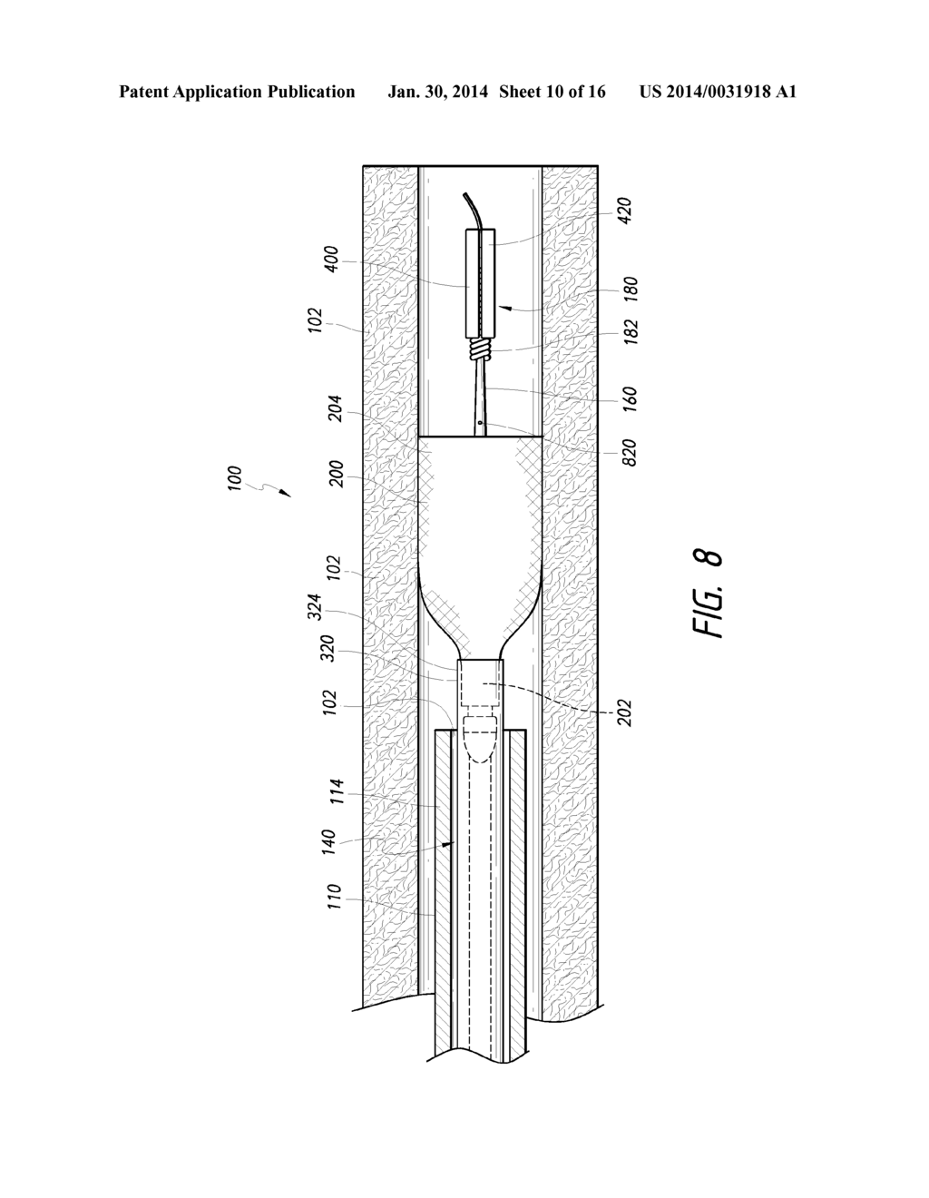 LUMINAL STENTING - diagram, schematic, and image 11