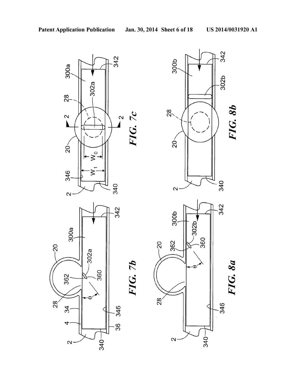 ENDOVASCULAR STENT - diagram, schematic, and image 07