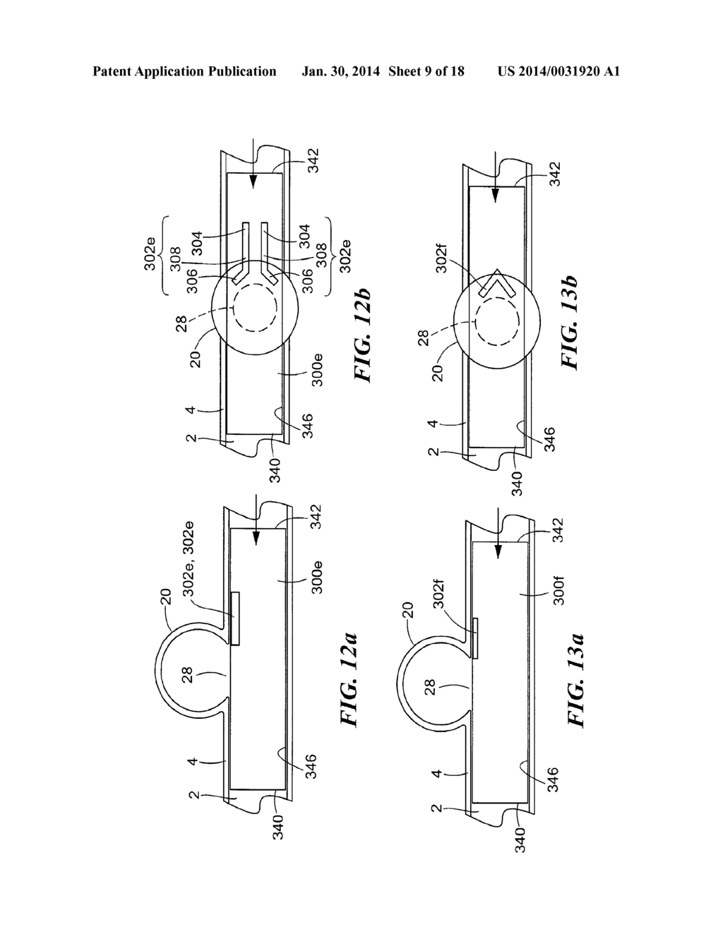 ENDOVASCULAR STENT - diagram, schematic, and image 10