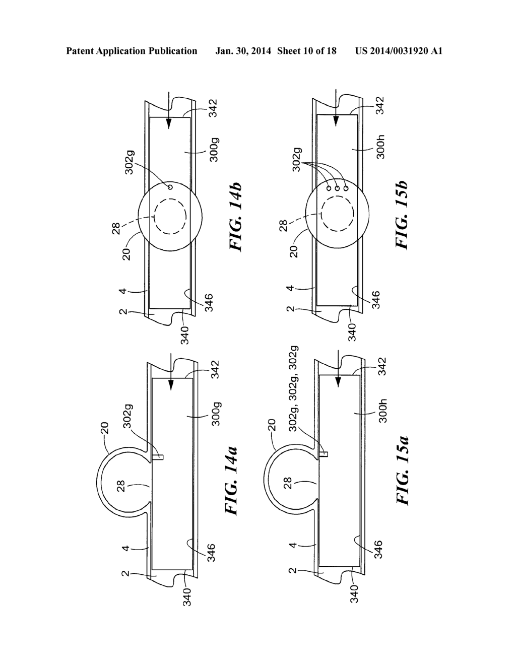 ENDOVASCULAR STENT - diagram, schematic, and image 11