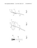 Device and Method for Heart Valve Repair diagram and image