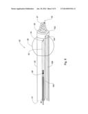 Device and Method for Heart Valve Repair diagram and image