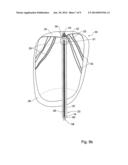 Device and Method for Heart Valve Repair diagram and image