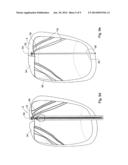 Device and Method for Heart Valve Repair diagram and image