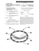 IMPLANTABLE DEVICES FOR CONTROLLING THE INTERNAL CIRCUMFERENCE OF AN     ANATOMIC ORIFICE OR LUMEN diagram and image