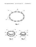 IMPLANTABLE DEVICES FOR CONTROLLING THE INTERNAL CIRCUMFERENCE OF AN     ANATOMIC ORIFICE OR LUMEN diagram and image