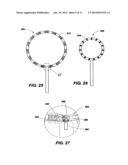 IMPLANTABLE DEVICES FOR CONTROLLING THE INTERNAL CIRCUMFERENCE OF AN     ANATOMIC ORIFICE OR LUMEN diagram and image