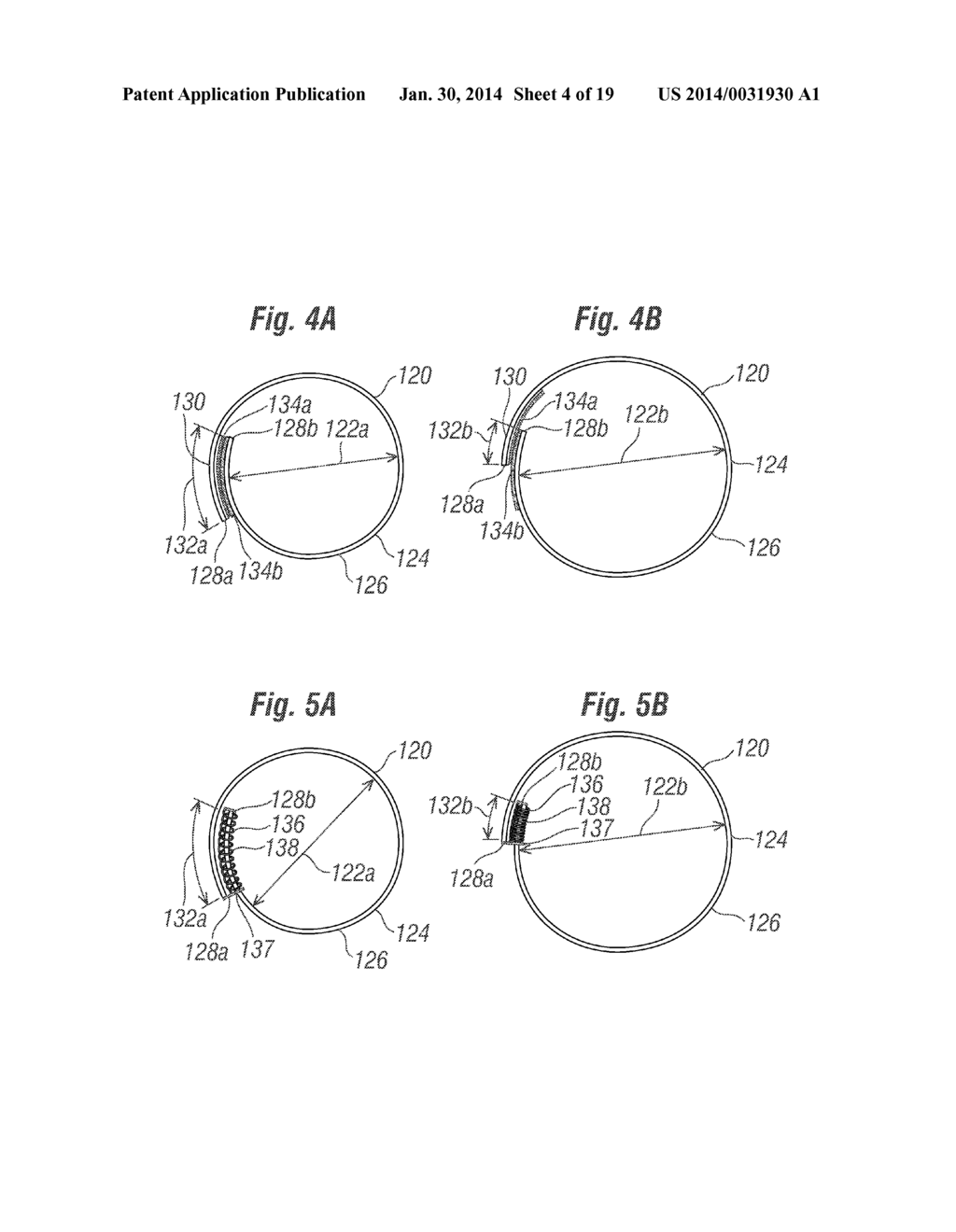 CARDIAC IMPLANT CONFIGURED TO RECEIVE A PERCUTANEOUS PROSTHETIC HEART     VALVE IMPLANTATION - diagram, schematic, and image 05