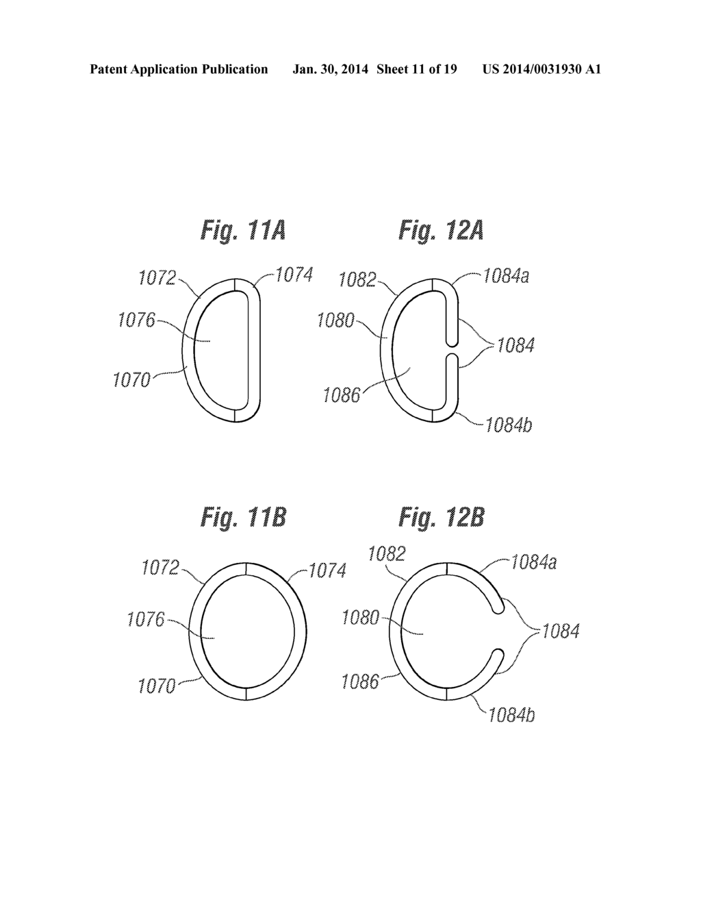 CARDIAC IMPLANT CONFIGURED TO RECEIVE A PERCUTANEOUS PROSTHETIC HEART     VALVE IMPLANTATION - diagram, schematic, and image 12