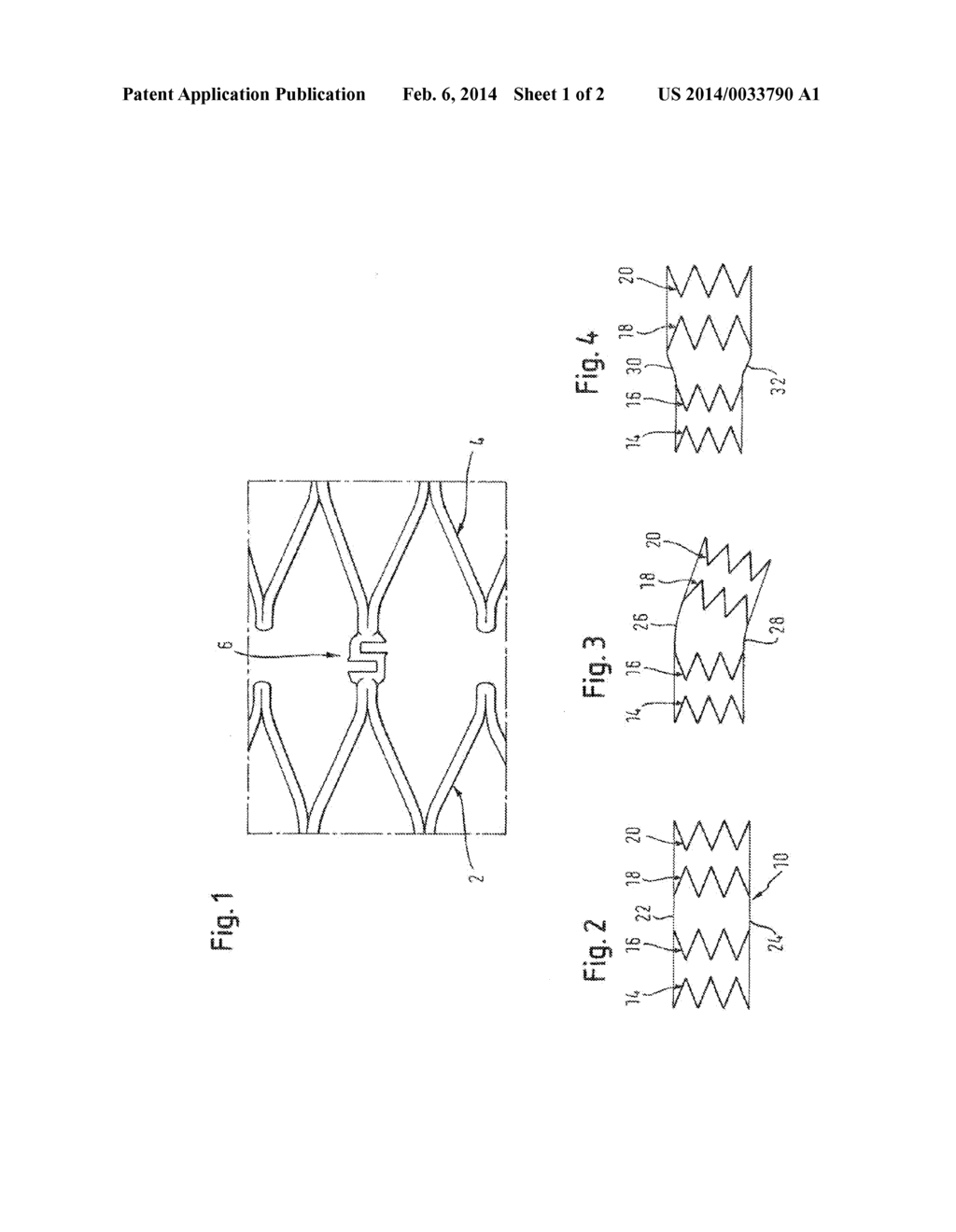 Stent - diagram, schematic, and image 02