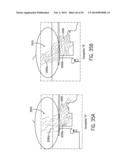 DOWNDRAFT SYSTEM diagram and image