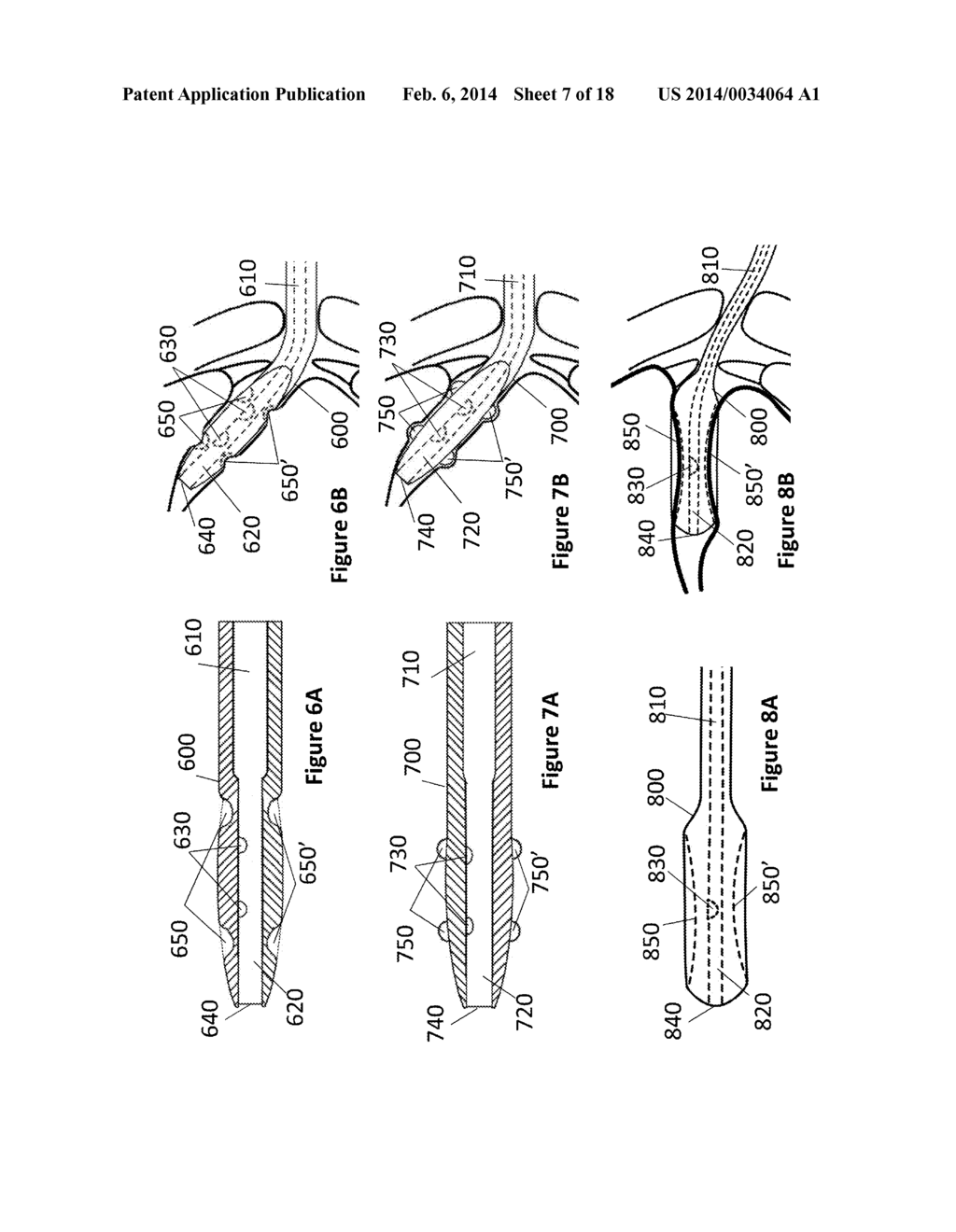 Oral Interface and Method using the Same - diagram, schematic, and image 08