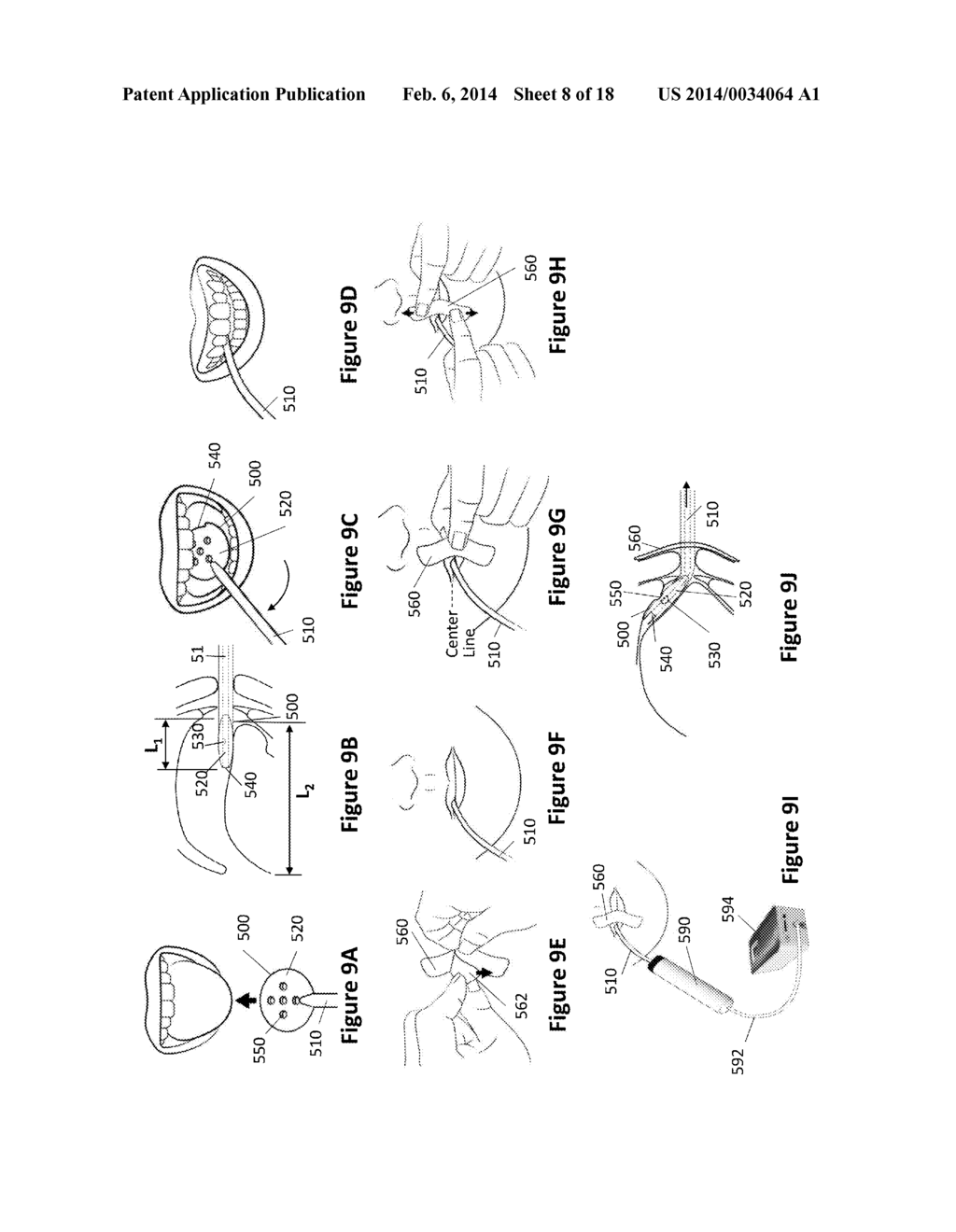 Oral Interface and Method using the Same - diagram, schematic, and image 09