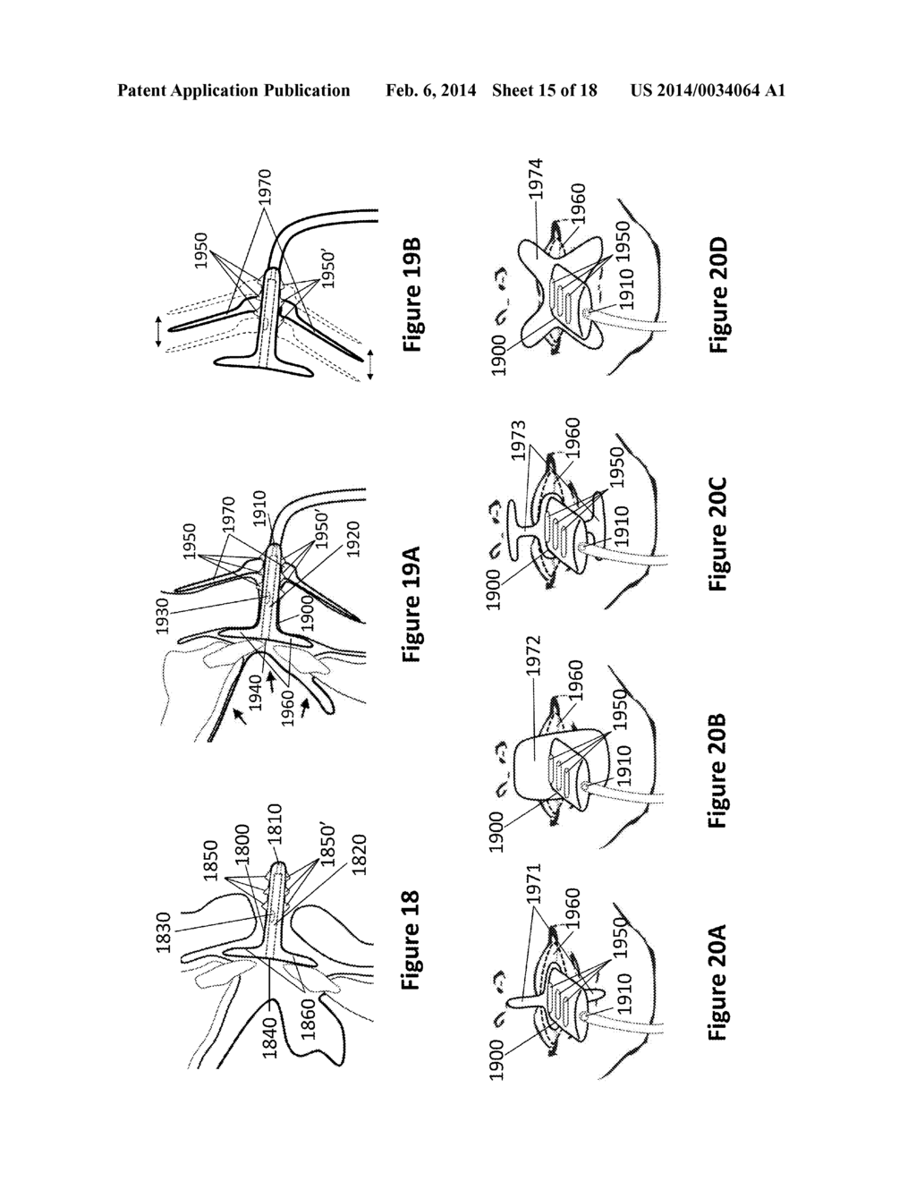 Oral Interface and Method using the Same - diagram, schematic, and image 16