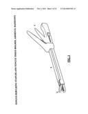 Tongue debulking stapler and tongue tissue holder diagram and image