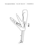 Tongue debulking stapler and tongue tissue holder diagram and image