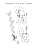 Tongue debulking stapler and tongue tissue holder diagram and image