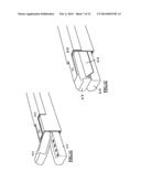 Tongue debulking stapler and tongue tissue holder diagram and image