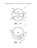 DIVIDED CONDUIT EXTRUSION DIE AND METHOD FOR ONE OR MORE MATERIAL LAYERS diagram and image