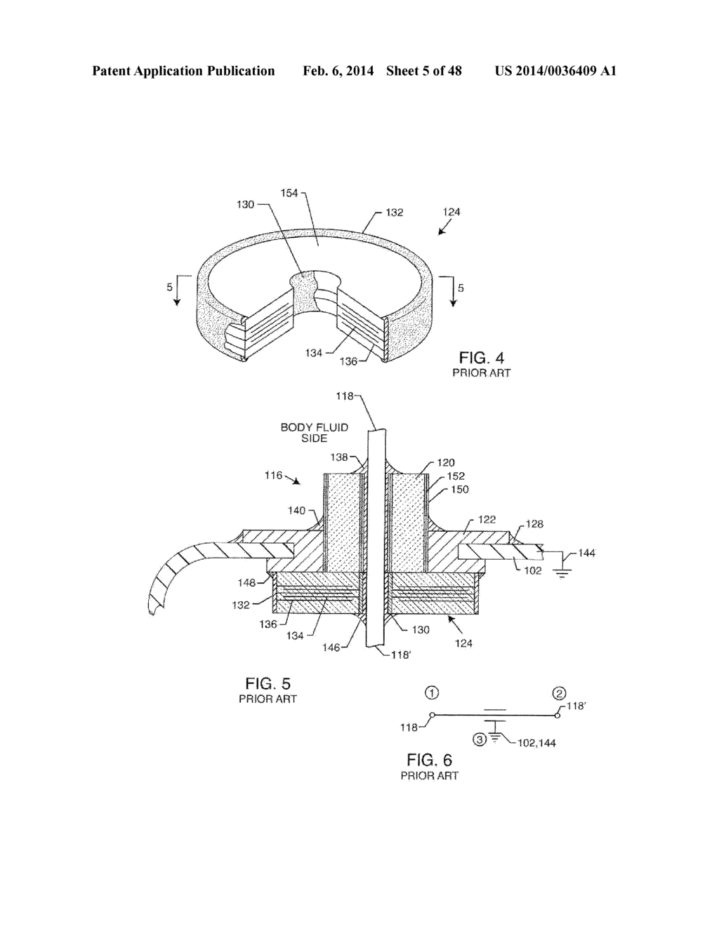 EMI Filtered Co-Connected Hermetic Feedthrough, Feedthrough Capacitor and     Leadwire Assembly for an Active Implantable Medical Device - diagram, schematic, and image 06