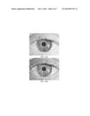 IDENTITY RECOGNITION BASED ON MULTIPLE FEATURE FUSION FOR AN EYE IMAGE diagram and image