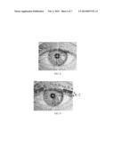 IDENTITY RECOGNITION BASED ON MULTIPLE FEATURE FUSION FOR AN EYE IMAGE diagram and image