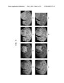 ENHANCED MULTI-PROTOCOL ANALYSIS VIA INTELLIGENT SUPERVISED EMBEDDING     (EMPRAVISE) FOR MULTIMODAL DATA FUSION diagram and image