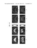 ENHANCED MULTI-PROTOCOL ANALYSIS VIA INTELLIGENT SUPERVISED EMBEDDING     (EMPRAVISE) FOR MULTIMODAL DATA FUSION diagram and image