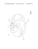 Rotary Blood Pump With Opposing Spindle Magnets, Bore And Drive Windings diagram and image