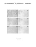 INHIBITION OF FIBROSIS AND AF BY TGF-BETA INHIBITION IN THE POSTERIOR LEFT     ATRIUM (PLA) diagram and image