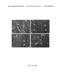 INHIBITION OF FIBROSIS AND AF BY TGF-BETA INHIBITION IN THE POSTERIOR LEFT     ATRIUM (PLA) diagram and image