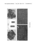 INHIBITION OF FIBROSIS AND AF BY TGF-BETA INHIBITION IN THE POSTERIOR LEFT     ATRIUM (PLA) diagram and image