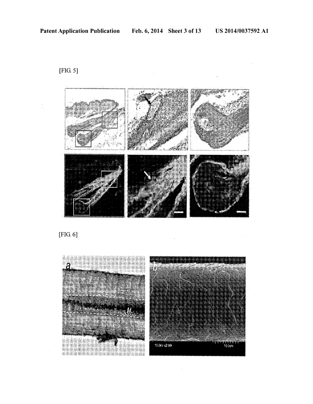 METHOD FOR PRODUCING REGENERATIVE ORGAN PRIMORDIUM PROVIDED WITH GUIDE FOR     TRANSPLANTATION, COMPOSITION CONTAINING REGENERATIVE ORGAN PRIMORDIUM     PROVIDED WITH GUIDE FOR TRANSPLANTATION PRODUCED THEREBY, AND METHOD FOR     TRNSPLANTING REGENERATIVE ORGAN PRIMORDIUM PROVIDED WITH GUIDE FOR     TRANSPLANTATION - diagram, schematic, and image 04