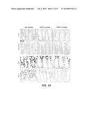 ANTI-NOTCH2 NRR ANTIBODIES diagram and image