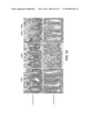 ANTI-NOTCH2 NRR ANTIBODIES diagram and image