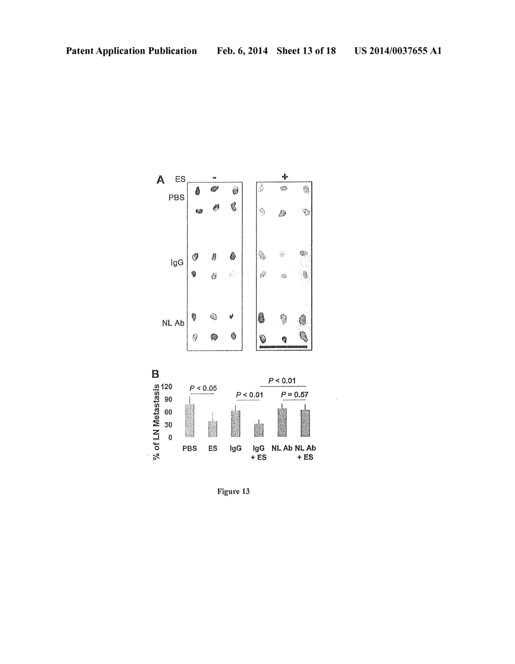 USE OF NUCLEOLIN AS A BIOMARKER FOR LYMPHANGIOGENESIS IN A CANCER     PROGNOSIS AND THERAPY - diagram, schematic, and image 14