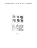 USE OF NUCLEOLIN AS A BIOMARKER FOR LYMPHANGIOGENESIS IN A CANCER     PROGNOSIS AND THERAPY diagram and image