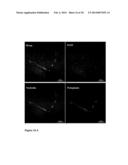 USE OF NUCLEOLIN AS A BIOMARKER FOR LYMPHANGIOGENESIS IN A CANCER     PROGNOSIS AND THERAPY diagram and image