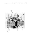 TRANSDERMAL PAIN GEL diagram and image