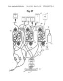 AUTOMATED METHODS AND SYSTEMS FOR PROVIDING PLATELET CONCENTRATES WITH     REDUCED RESIDUAL PLASMA VOLUMES AND STORAGE MEDIA FOR SUCH PLATELET     CONCENTRATES diagram and image