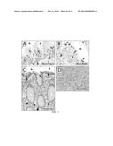 5-HYDROXYMETHYLCYTOSINE IN HUMAN CANCER diagram and image