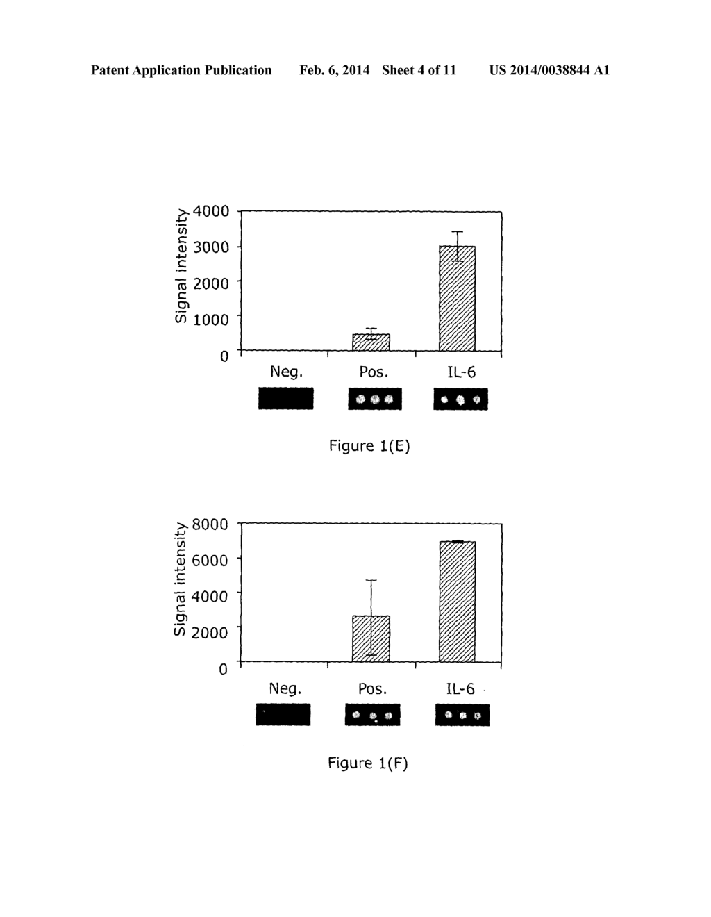 Method, Array and Use for Determining the Presence of Pancreatic Cancer - diagram, schematic, and image 05