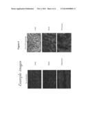 ADIPONECTIN RECEPTOR C-TERMINAL FRAGMENTS (CTF)-IMMUNOGLOBULIN diagram and image