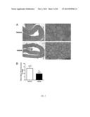 THERAPEUTIC AND DIAGNOSTIC METHODS INVOLVING BIGLYCAN AND UTROPHIN diagram and image