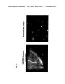 POLYMALIC ACID-BASED MULTIFUNCTIONAL DRUG DELIVERY SYSTEM diagram and image